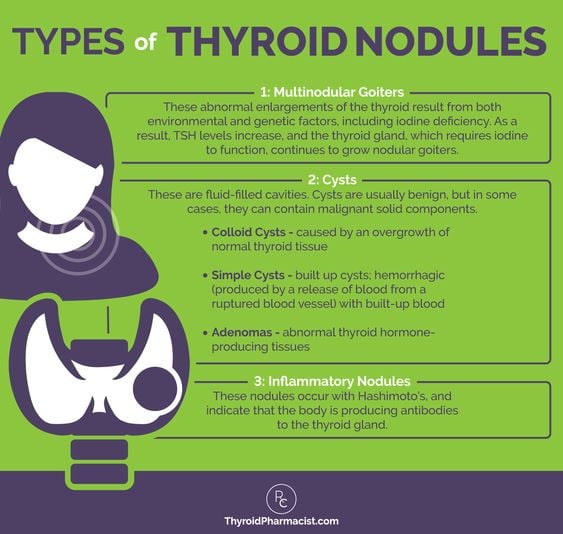 Thyroid Nodules Classification