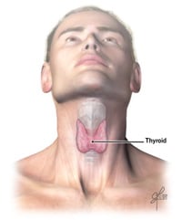 La tiroidectomía