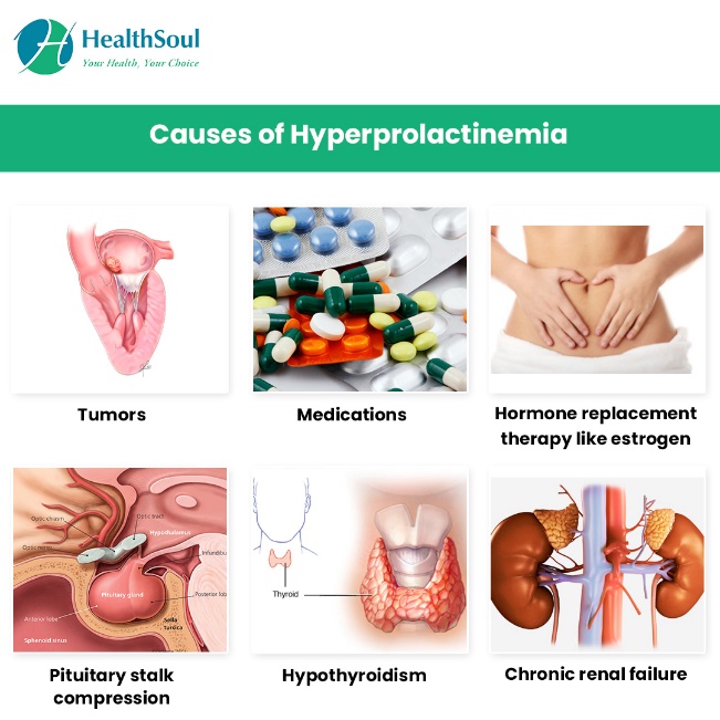 causes de l'hyperprolactinémie