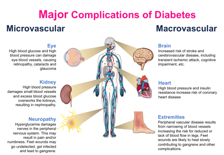 complications du diabète