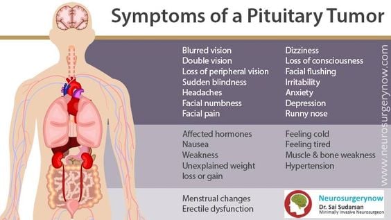 symptoms of pituitary tumor