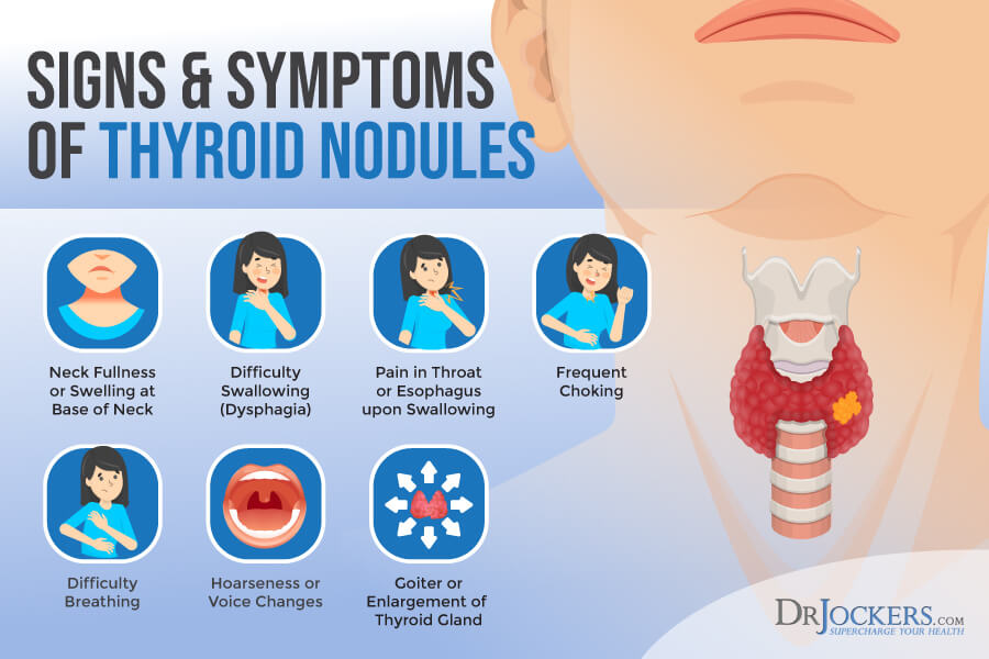 symptoms of thyroid nodules