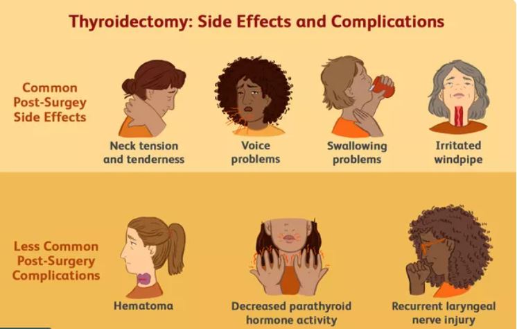 thyroïdectomie : effets secondaires et complications