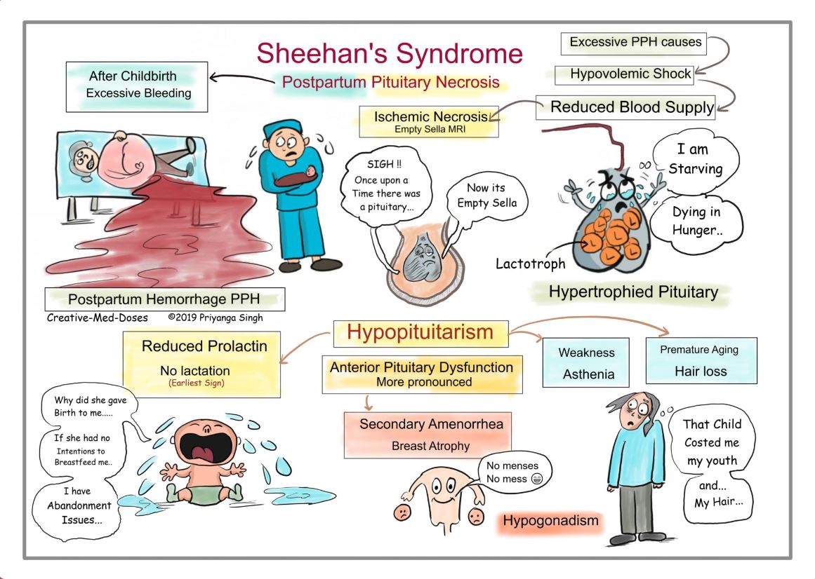 Sheehan-Syndrom