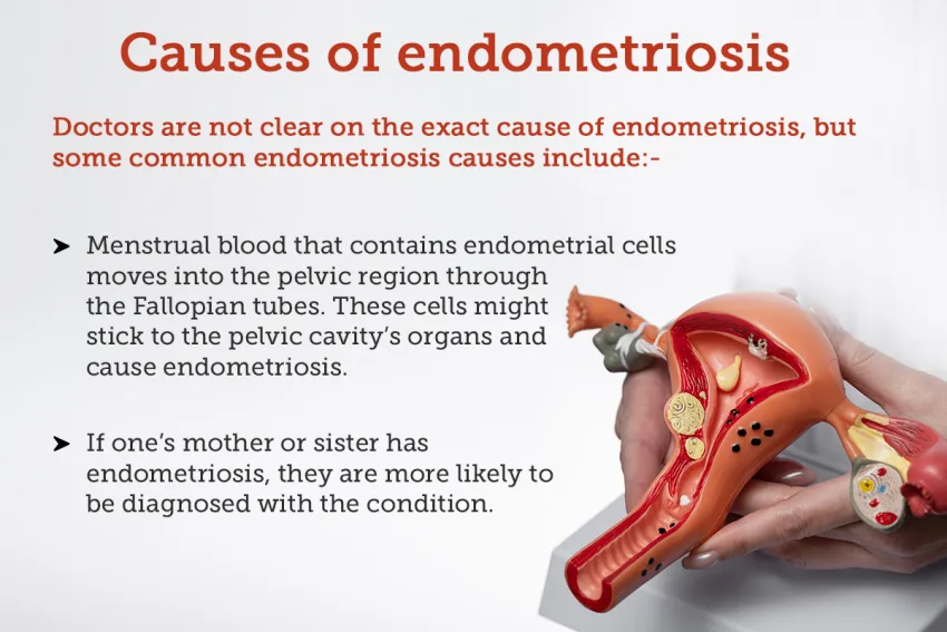causes de l'endométriose