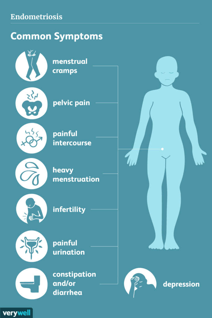 Symptome der Endometriose