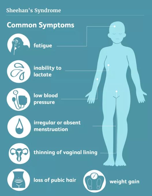 symptoms of Sheehan’s syndrome