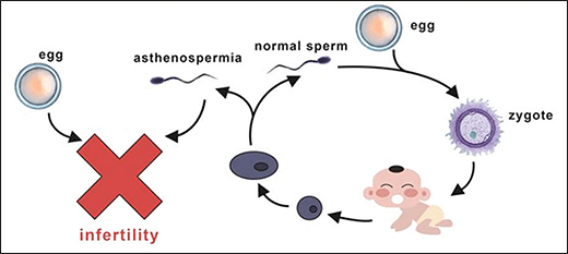 Asthenoteratozoospermia and Infertility