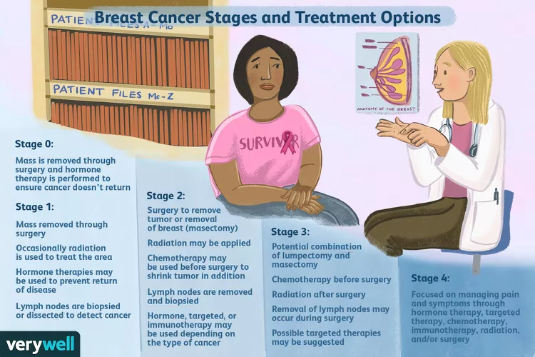 Invasive ductal carcinoma treatment options