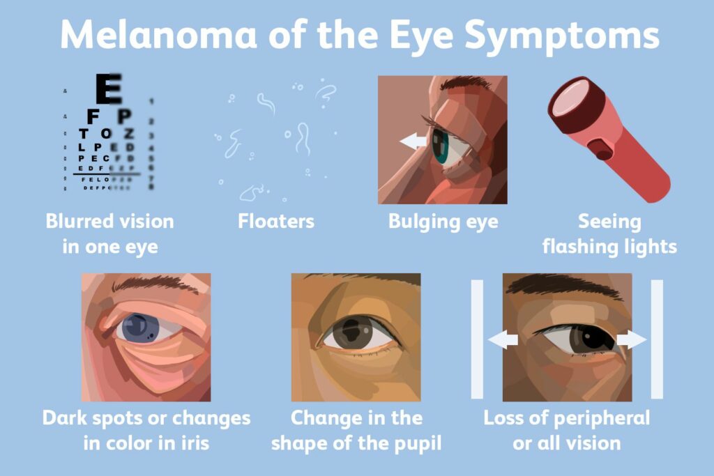 أعراض سرطان الجلد العيني