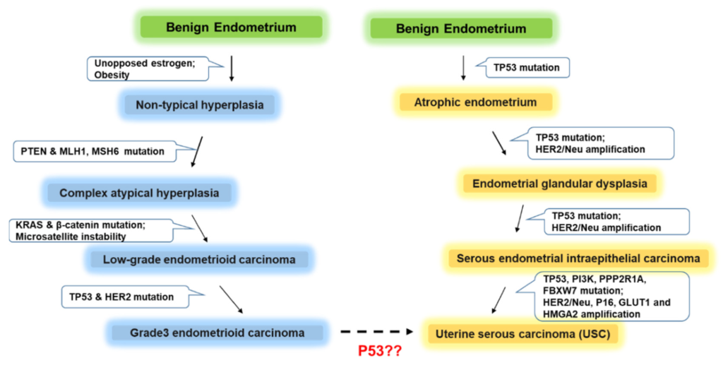 What causes papillary serous carcinoma