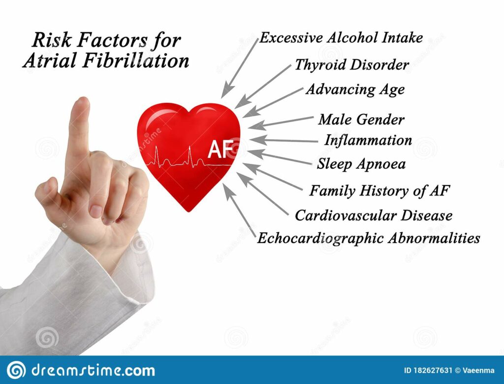 facteurs de risque de la fibrillation auriculaire