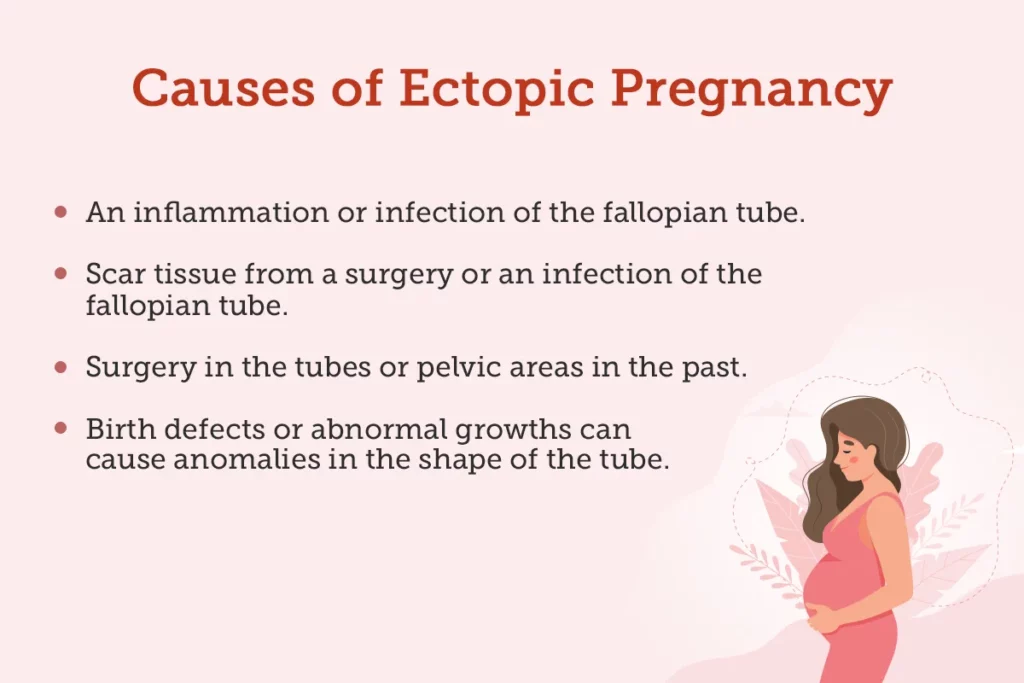cause of ectopic pregnancy