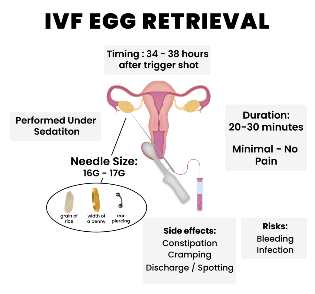 IVF Harvesting Eggs/Egg Retrieval Procedure 