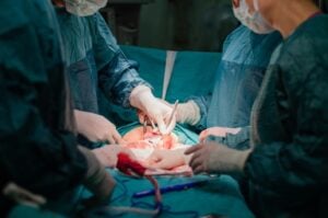 abdominal hysterectomy surgery