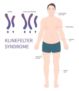 Klinefelter Syndrome causes