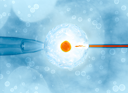 Types of Assisted Reproductive Technology