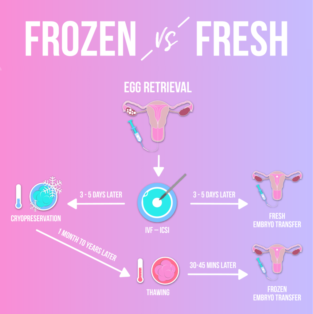 Vor- und Nachteile von Transfers frischer und gefrorener Embryonen – Bild