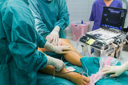 Percutaneous transluminal angioplasty surgery treatment