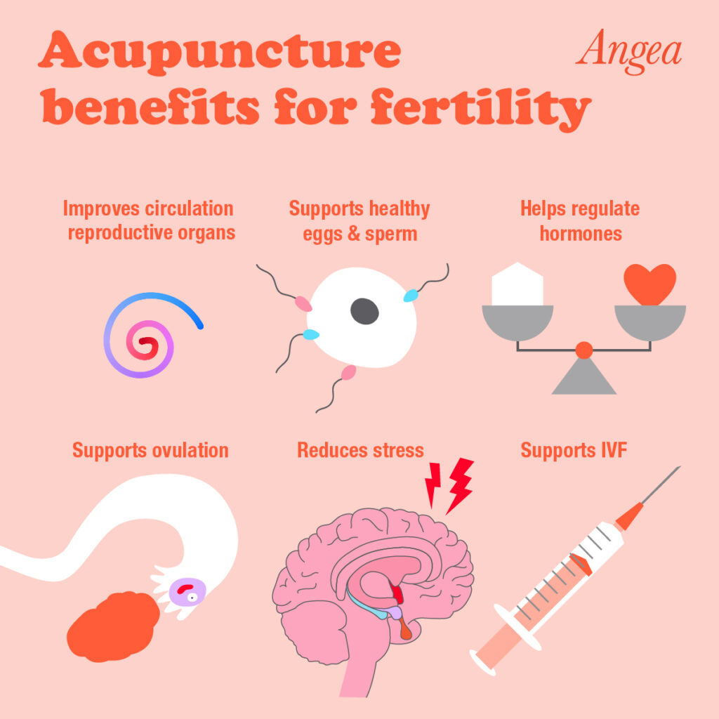 What are the Benefits of Acupuncture for Fertility?