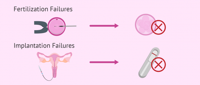 IVF After Multiple Failed Attempts- why