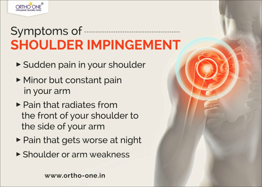 Shoulder Impingement: Symptoms