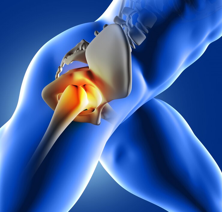 بدائل جراحة استبدال الركبة أو الورك: استكشاف الخيارات غير الجراحية