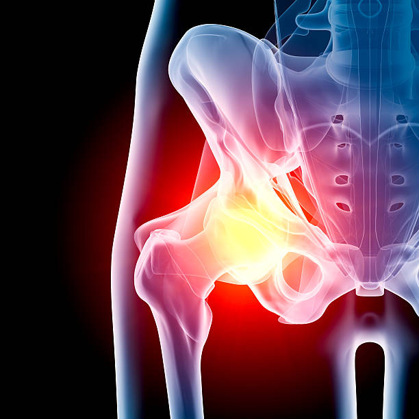 Alternativas a la cirugía de reemplazo de rodilla o cadera: exploración de opciones no quirúrgicas