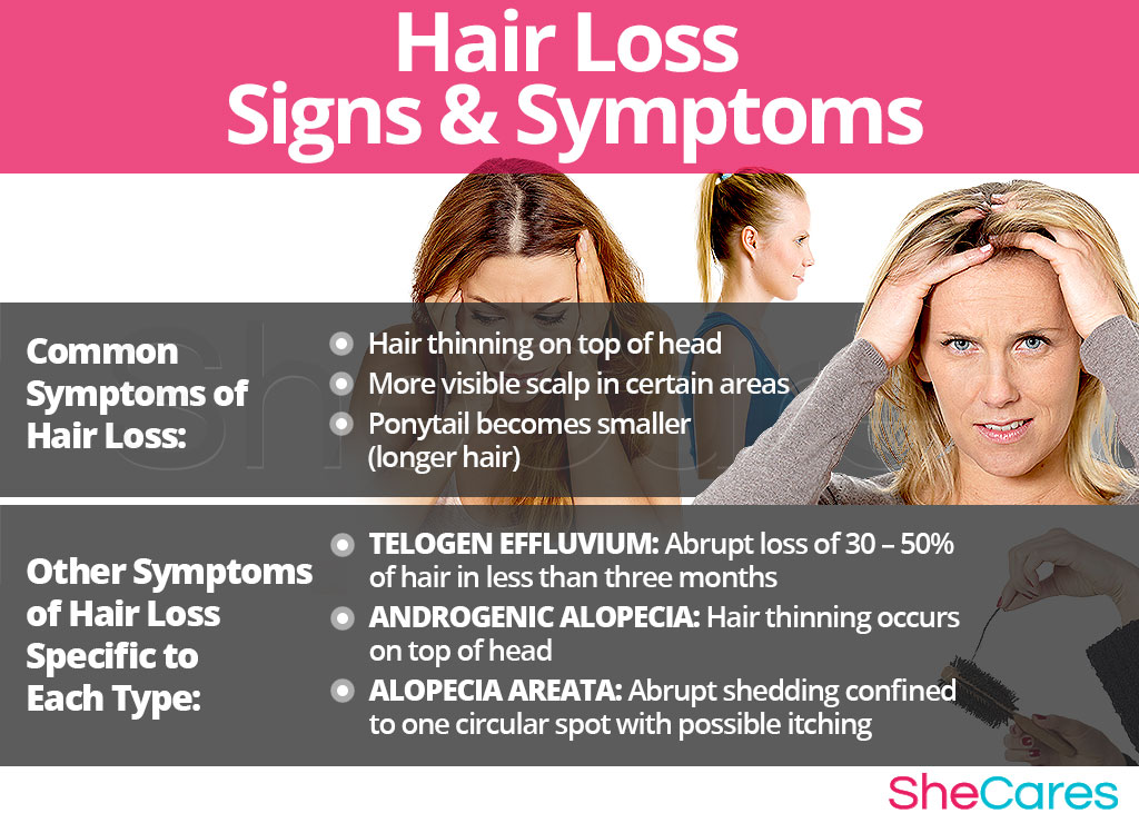 Pérdida de cabello debido a desequilibrio hormonal en mujeres - síntomas