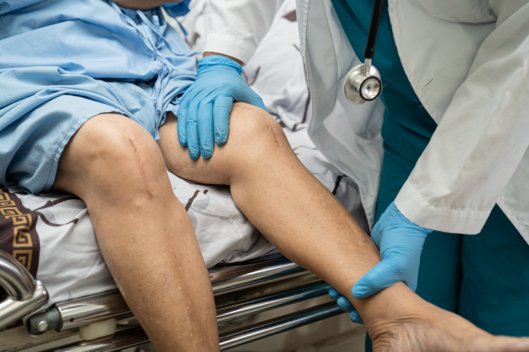 الجدول الزمني للتعافي من استبدال الركبة: ما يمكن توقعه بعد الجراحة