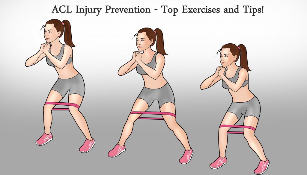 exercises to prevent ACL tears