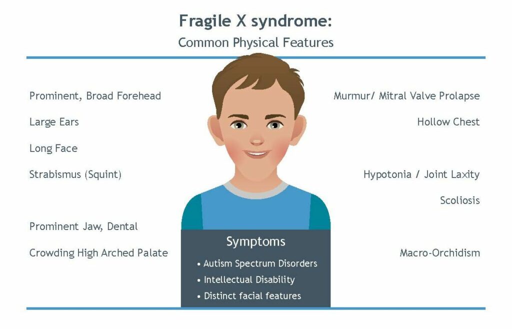 متلازمة X الهشة والخصوبة: كسر الحواجز أمام الأبوة - الأعراض