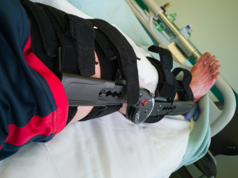 Recovering From ACL Reconstruction: Tips for a Successful Rehabilitation 