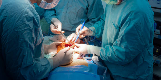 Хирургия колоректального рака в Канаде: хирургические процедуры и советы по восстановлению