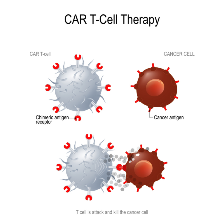 Terapia de células T con receptor de antígeno quimérico (CAR) en Canadá