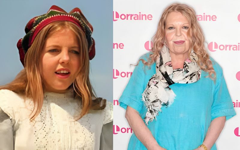Sally Thomsett s Plastic Surgery Transformation Sally Thomsett s Plastic Surgery Transformation